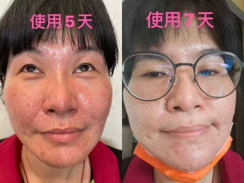 2026年7月推荐：长兴县专业的玻尿酸精华液/精华液招商加盟推荐几家