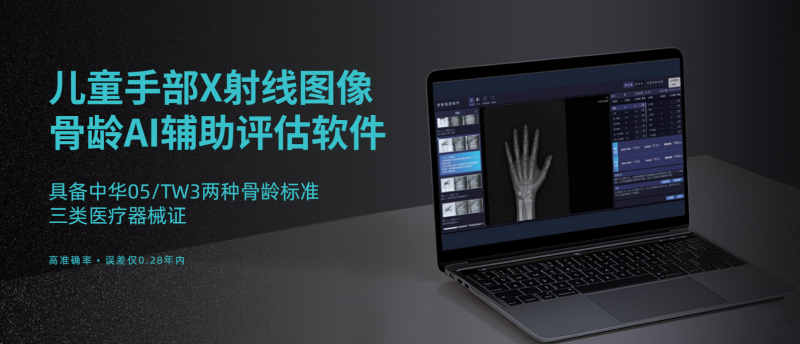 2026年7月指南：行业内靠谱的骨龄分析仪/骨龄检测仪制造厂家盘点-安智康