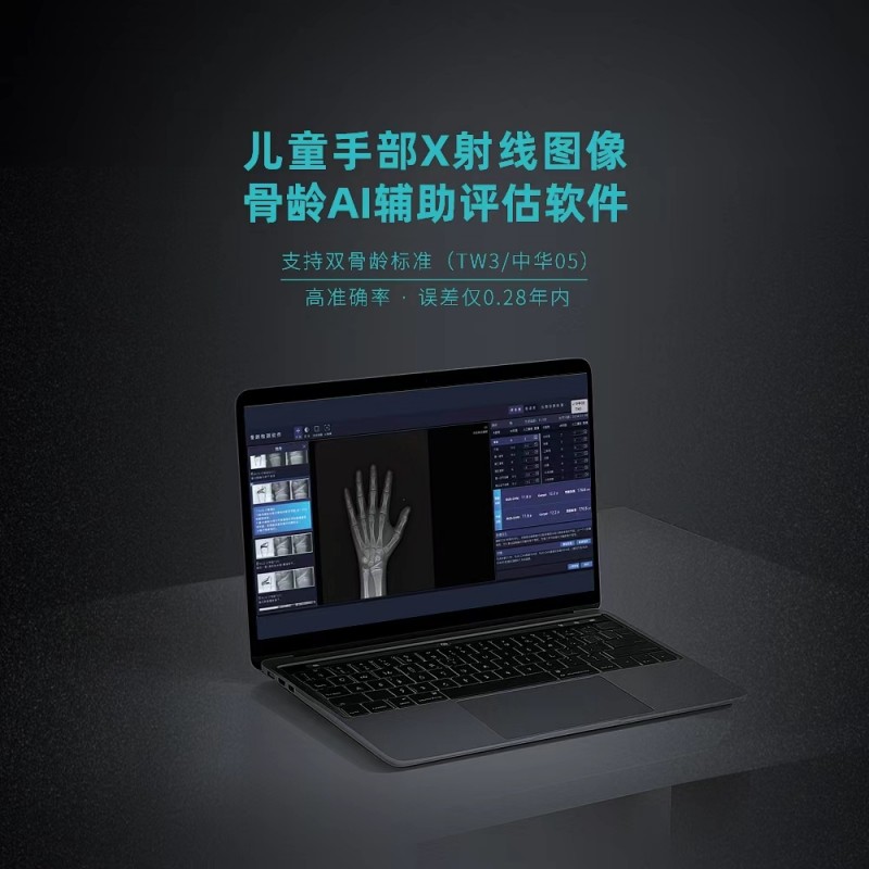 2026年7月指南：市面上热门的儿童骨龄测评系统/骨龄评估软件供应商精选-安智康
